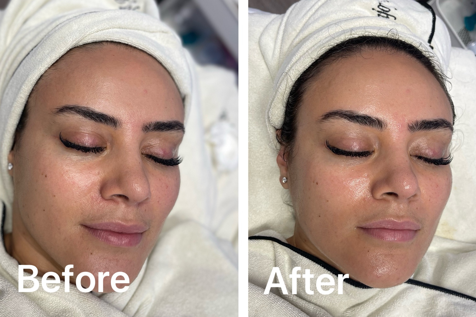 Before and after facial showing visibly refreshed and luminous skin