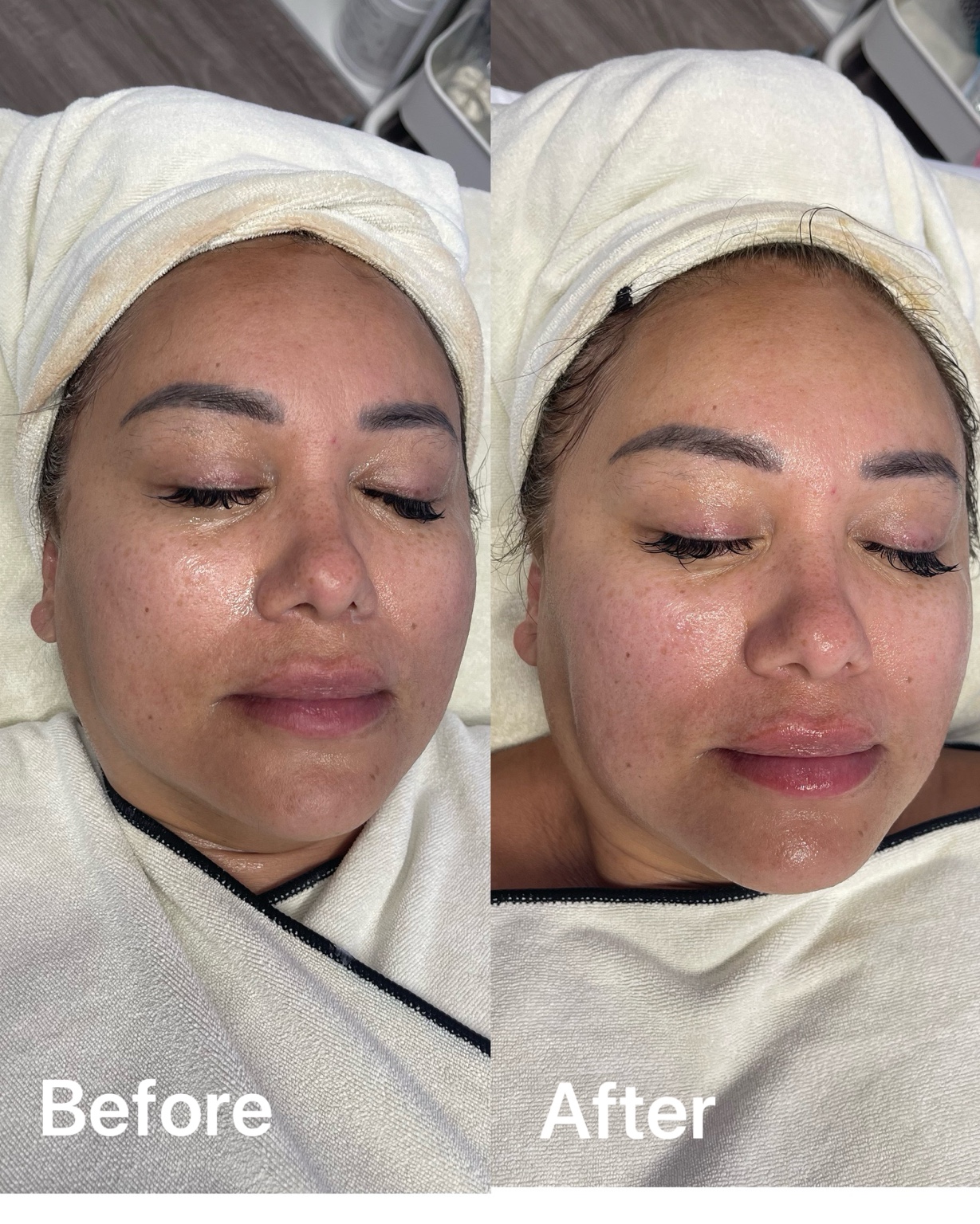 Before and after facial showing visibly refreshed and luminous skin